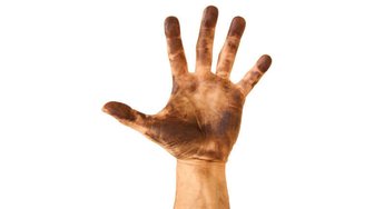Dirty hand raised against a stark background, symbolizing alleged corruption and misuse of lottery funds discussed in the ...